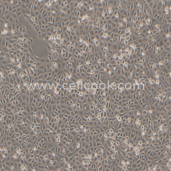 HK-2人腎皮質(zhì)近曲小管上皮細(xì)胞（STR鑒定正確）