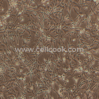 WPMY-1人正常前列腺基質(zhì)永生化細(xì)胞（STR鑒定正確）