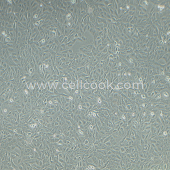 GES-1人胃粘膜上皮細(xì)胞（STR鑒定正確）