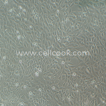 AC16人心肌細(xì)胞（STR鑒定正確）