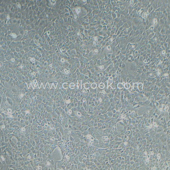 Nthy-ori 3-1人甲狀腺濾泡上皮細(xì)胞（STR鑒定正確）