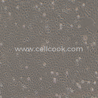 NP69人鼻咽上皮細(xì)胞（STR鑒定正確）