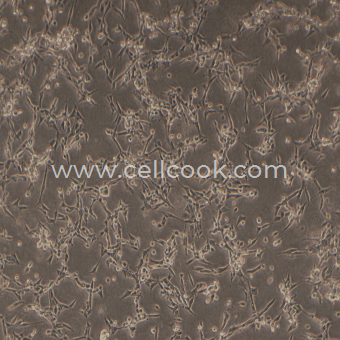 HCEC-B4G12人角膜內(nèi)皮細(xì)胞（STR鑒定正確）