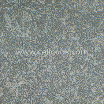 RM-1小鼠前列腺癌細(xì)胞（STR鑒定正確）