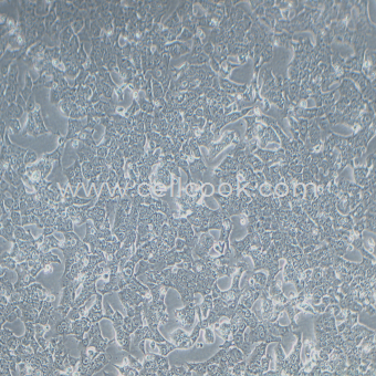 HePa1-6小鼠肝癌細(xì)胞（STR鑒定正確）