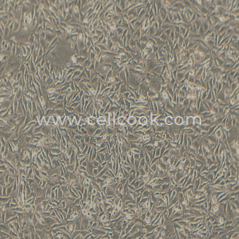 B16-F10小鼠黑色素瘤細(xì)胞（STR鑒定正確）