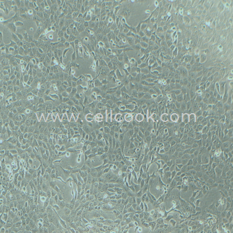 4T1小鼠乳腺癌細(xì)胞（STR鑒定正確）