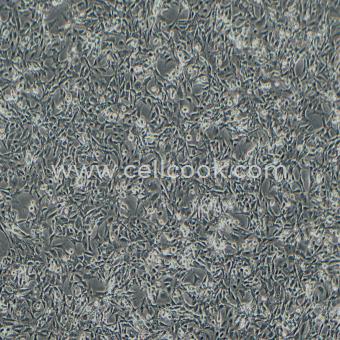 SV40 MES 13小鼠腎小球系膜細(xì)胞（種屬鑒定正確）