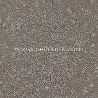 OP9小鼠骨髓基質(zhì)細(xì)胞（種屬鑒定正確）