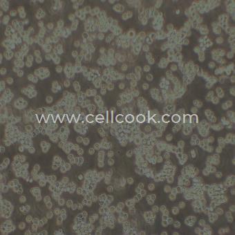 A20小鼠B細(xì)胞淋巴瘤（STR鑒定正確）