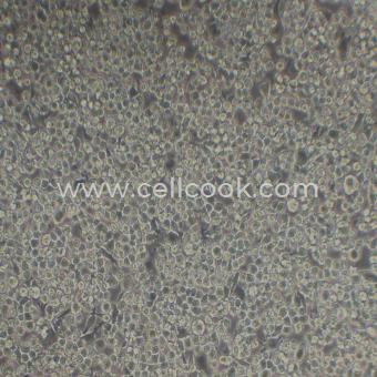 DC2.4小鼠樹突狀細(xì)胞（STR鑒定正確）