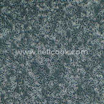 PC-12(低分化)大鼠腎上腺嗜鉻細胞瘤細胞(低分化)（種屬鑒定正確）