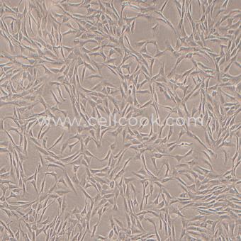 NRK-49F正常大鼠腎細胞（種屬鑒定正確）