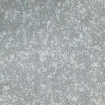 HSCT6大鼠肝星狀細胞（種屬鑒定正確）