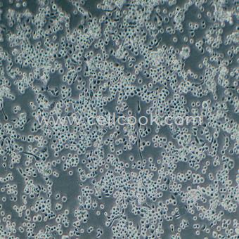 SF9夜蛾卵巢細(xì)胞（種屬鑒定正確）