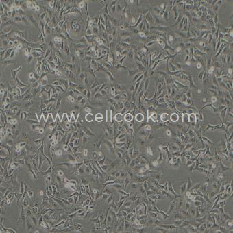 A549-DDP人非小細胞肺癌細胞順鉑耐藥株（STR鑒定正確）