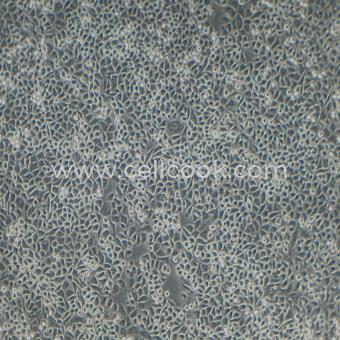 PC9-DDP人非小細胞肺癌細胞順鉑耐藥株（STR鑒定正確）