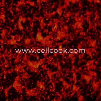 SH-SY5Y-RFP示蹤穩(wěn)定細(xì)胞株（STR鑒定正確）