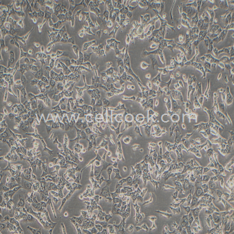 HePa1-6-LUC示蹤穩(wěn)定細(xì)胞株（STR鑒定正確）