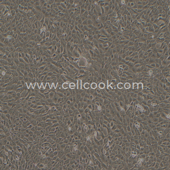 4T1-LUC示蹤穩(wěn)定細(xì)胞株（STR鑒定正確）