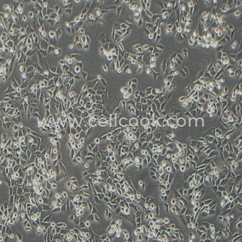 SK-HEP-1人肝腹水腺癌細(xì)胞（STR鑒定正確）