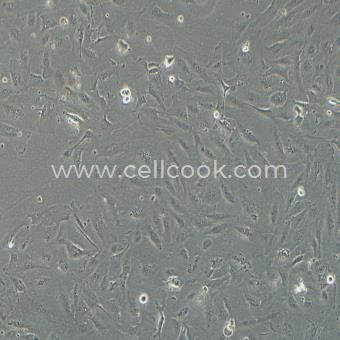 SNU-423人肝癌細胞（STR鑒定正確）