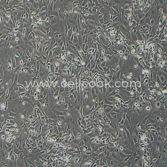 HCCC-9810人膽管細胞型肝癌細胞（STR鑒定正確）