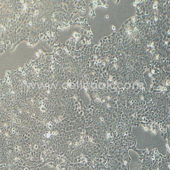 NCI-H1573人非小細胞肺腺癌細胞（STR鑒定正確）