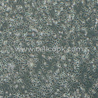 NCI-H1703人肺鱗癌細胞（STR鑒定正確）