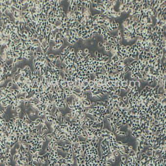 NCI-H3122人肺腺癌細胞（STR鑒定正確）