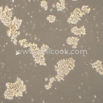 SHP-77人肺癌細(xì)胞（STR鑒定正確）