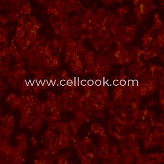 Cal-27-RFP示蹤穩(wěn)定細(xì)胞株（STR鑒定正確）