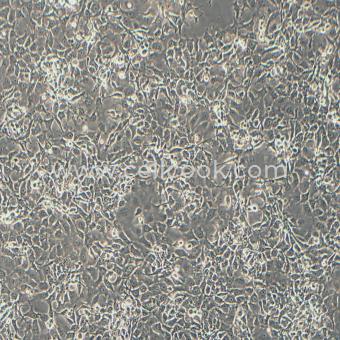 FaDu人咽鱗癌細胞（STR鑒定正確）