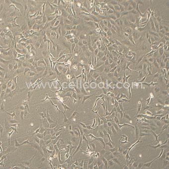 SK-OV-3人卵巢腺癌細胞（STR鑒定正確）