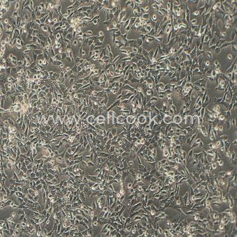 UM-UC-3人膀胱移行細(xì)胞癌細(xì)胞（STR鑒定正確）