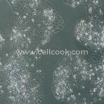 BeWo人胎盤絨膜癌細(xì)胞（STR鑒定正確）