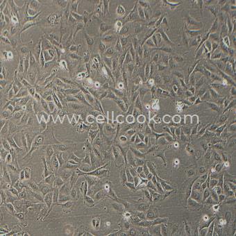 J82人膀胱移行細(xì)胞癌細(xì)胞（STR鑒定正確）