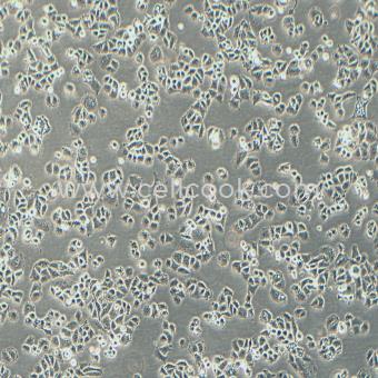 C-33A人宮頸癌細胞（STR鑒定正確）