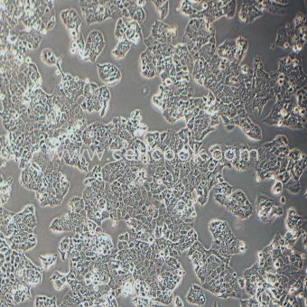 HEC-1-A人子宮內(nèi)膜腺癌細胞（STR鑒定正確）