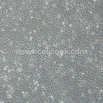 OS-RC-2人腎癌細(xì)胞（STR鑒定正確）