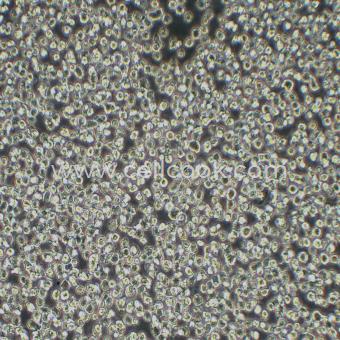 NCI-H929人骨髓瘤細(xì)胞（STR鑒定正確）