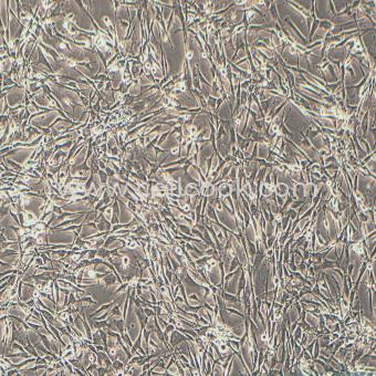 U-118 MG人腦星形膠質(zhì)母細(xì)胞瘤細(xì)胞（STR鑒定正確）