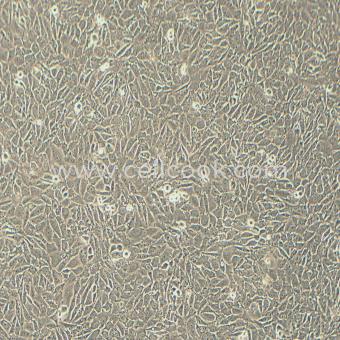 H4人腦神經(jīng)膠質(zhì)瘤細胞（STR鑒定正確）