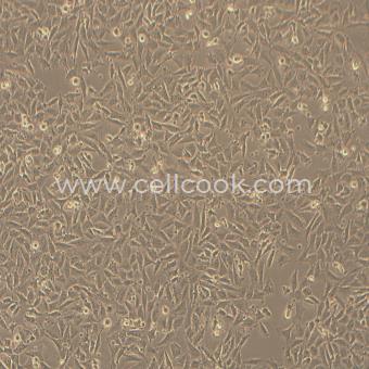 LN-18人腦膠質(zhì)母細胞瘤細胞（STR鑒定正確）