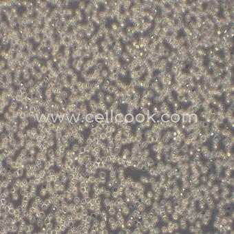 RS4;11人急性淋巴白血病細胞（STR鑒定正確）