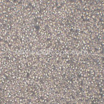 Reh人急性非B非T淋巴細胞白血病細胞（STR鑒定正確）