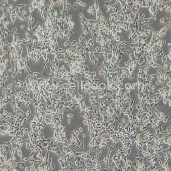 RD人惡性胚胎橫紋肌肉瘤細胞（STR鑒定正確）