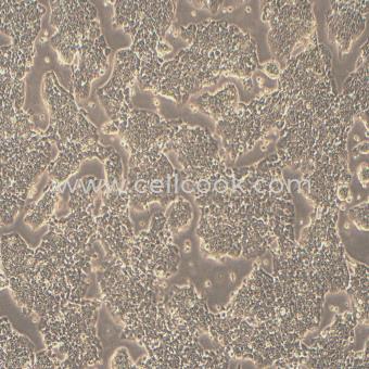 A-673人橫紋肌肉瘤細胞（STR鑒定正確）