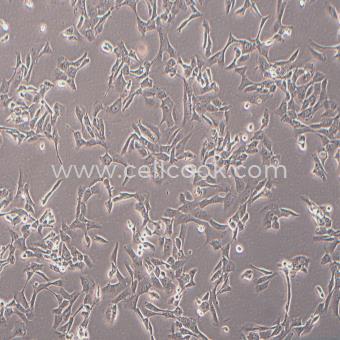 MNNG/HOS Cl #5 [R-1059-D]人骨肉瘤細胞（STR鑒定正確）
