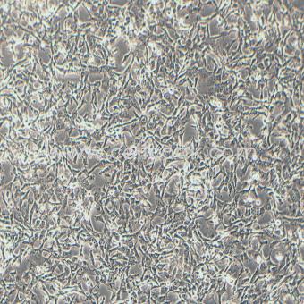 HT-1080人纖維肉瘤細胞（STR鑒定正確）